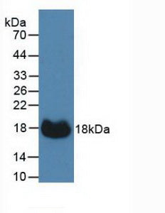 Carbonic Anhydrase XII (CA12) Polyclonal Antibody - image 3