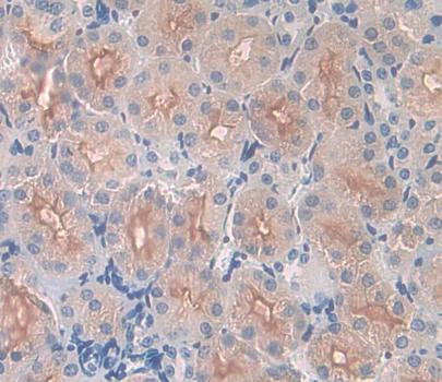 Carbonic Anhydrase XII (CA12) Polyclonal Antibody - image 4
