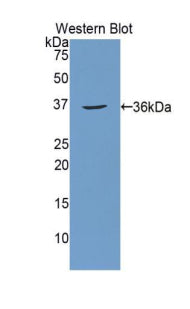 Western Blot; Sample: Lane1: Human Blood cell lysate; Lane2: Rat Kidney lysate; Lane3: Rat Stomach lysate; Primary Ab: 2µg/mL Rabbit Anti-Human CA12 Antibody; Second Ab: 0.2µg/mL HRP-Linked Caprine Anti-Rabbit IgG Polyclonal Antibody;