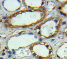 Carbonic Anhydrase XII (CA12) Polyclonal Antibody - image 4