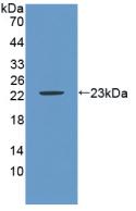 Western Blot; Sample: Mouse Cerebrum lysate; ; Primary Ab: 2µg/ml Rabbit Anti-Mouse CA9 Antibody; Second Ab: 0.2µg/mL HRP-Linked Caprine Anti-Rabbit IgG Polyclonal Antibody;