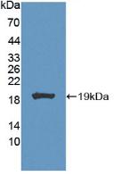 Carbonic Anhydrase VII (CA7) Polyclonal Antibody - image 2