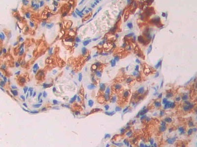 DAB staining on IHC-P; Samples: Mouse Pancreas Tissue