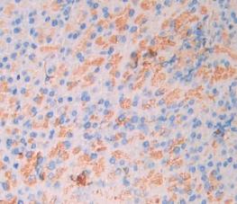 Carbonic Anhydrase VII (CA7) Polyclonal Antibody - image 4