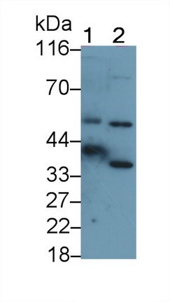 Carbonic Anhydrase VI (CA6) Polyclonal Antibody - image 2