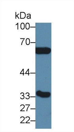 Western Blot; Sample: Recombinant protein.