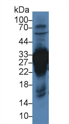 Western Blot; Sample: Recombinant protein.