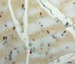 Carbonic Anhydrase III, Muscle Specific (CA3) Polyclonal Antibody - image 4