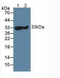 Western Blot; Sample: Recombinant CA3, Human.