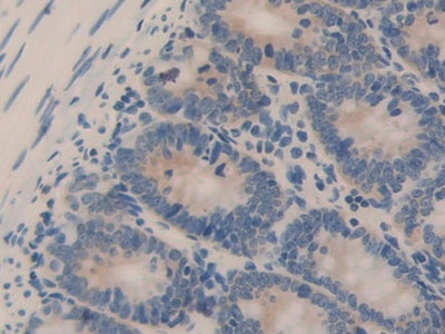 DAB staining on fromalin fixed paraffin- embedded lung tissue)