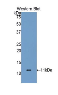 DAB staining on IHC-P; Samples: Human Tonsil Tissue; Primary Ab: 20μg/ml Rabbit Anti-Human HSPA8 Antibody Second Ab: 2µg/mL HRP-Linked Caprine Anti-Rabbit IgG Polyclonal Antibody