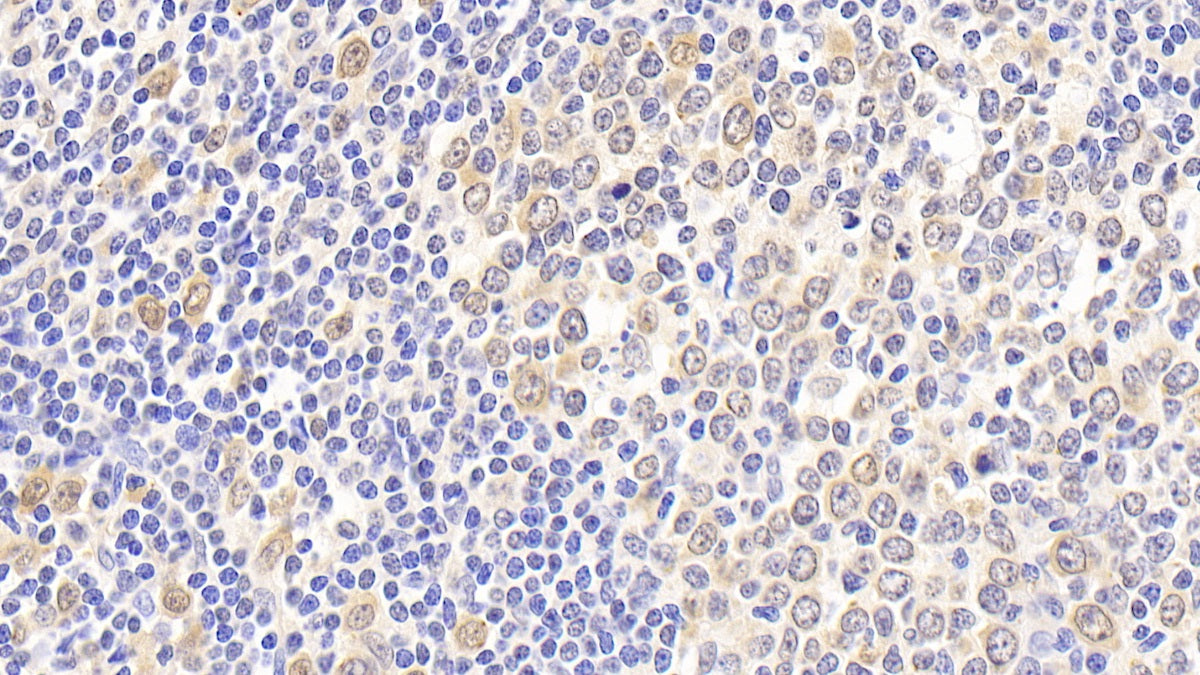 DAB staining on fromalin fixed paraffin-embedded Spleen tissue)
