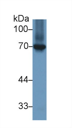 Western Blot; Sample: Recombinant protein.