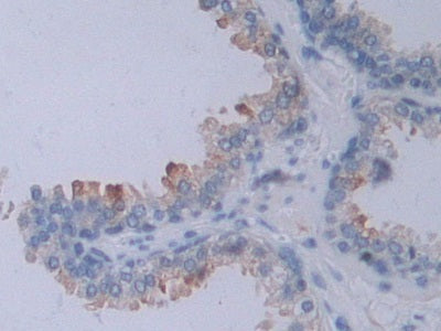 DAB staining on fromalin fixed paraffin-embedded ovary tissue)