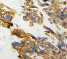 Neuropilin 2 (NRP2) Polyclonal Antibody - image 4