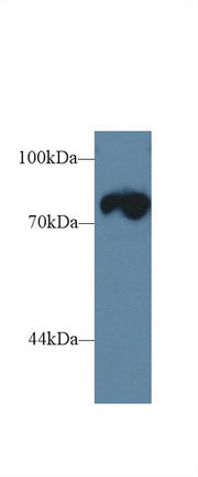 Western Blot; Sample: Recombinant protein.
