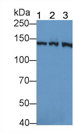 Valyl tRNA Synthetase (VARS) Polyclonal Antibody - image 2
