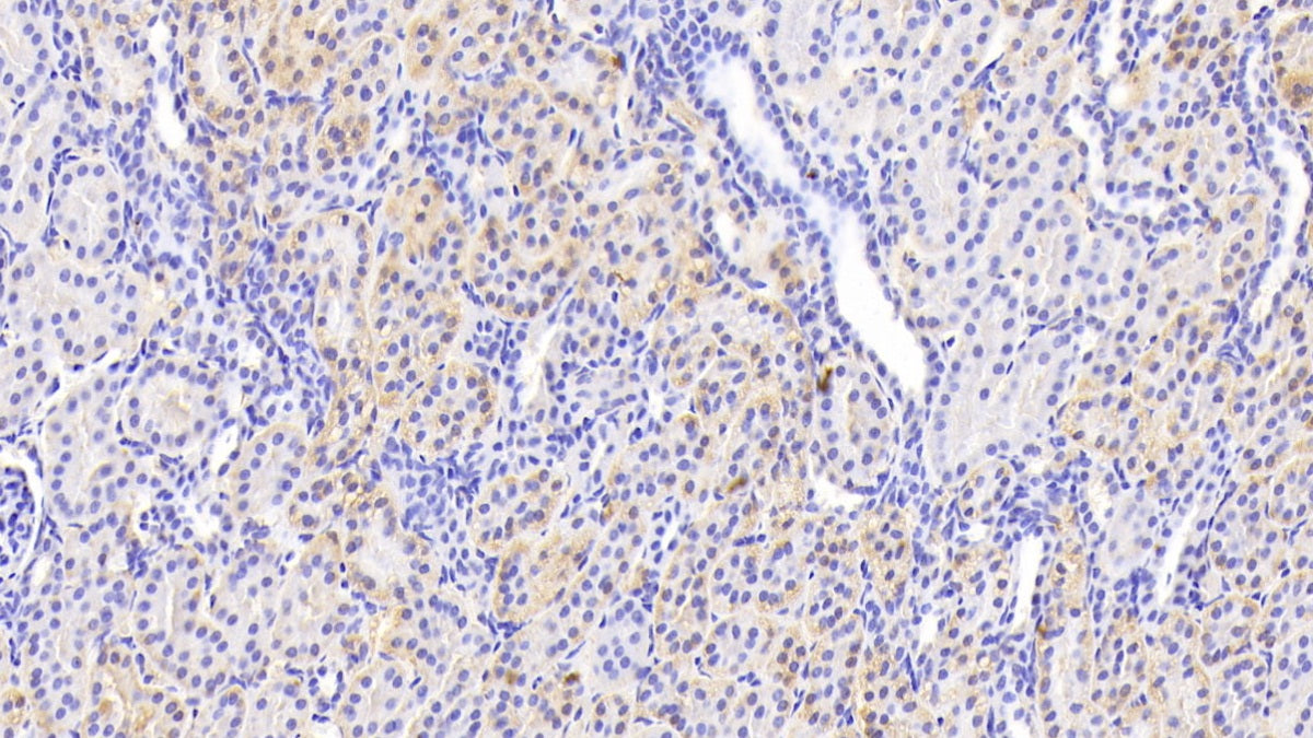 Valyl tRNA Synthetase (VARS) Polyclonal Antibody - image 4