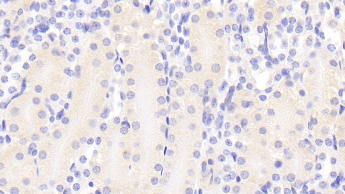 DAB staining on fromalin fixed paraffin- embedded kidney tissue)