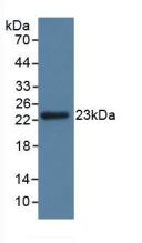 Western Blot; Sample: Rat Kidney lysate; ; Primary Ab: 3µg/ml Rabbit Anti-Mouse GPX3 Antibody; Second Ab: 0.2µg/mL HRP-Linked Caprine Anti-Rabbit IgG Polyclonal Antibody;