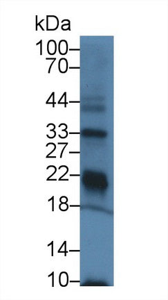 DAB staining on IHC-P; Samples: Mouse Kidney Tissue; Primary Ab: 20µg/ml Rabbit Anti-Mouse GPX3 Antibody Second Ab: 2µg/mL HRP-Linked Caprine Anti-Rabbit IgG Polyclonal Antibody