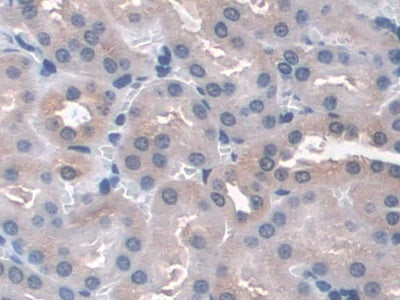 DAB staining on IHC-P; Samples: Mouse Heart Tissue.