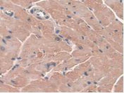 Glutathione Peroxidase 3, Plasma (GPX3) Polyclonal Antibody - image 5