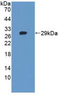 Tankyrase 2 (TNKS2) Polyclonal Antibody - image 2