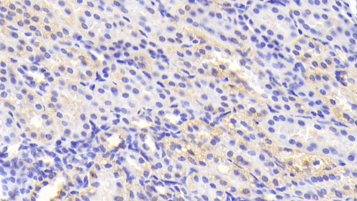 DAB staining on fromalin fixed paraffin- embedded liver tissue)