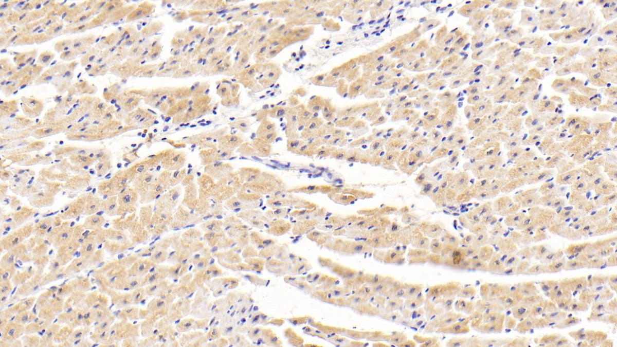 Tankyrase 2 (TNKS2) Polyclonal Antibody - image 4