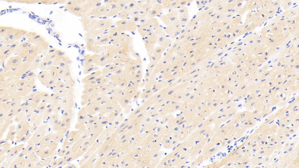 DABstainingonIHC-P.Samples:HumanTissue)