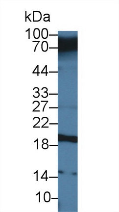 Western Blot; Sample: Recombinant protein.