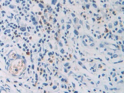 Carcinoembryonic Antigen Related Cell Adhesion Molecule 7 (CEACAM7) Polyclonal Antibody - image 5