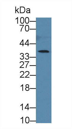 Western Blot; Sample: Recombinant protein.