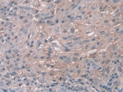 DAB staining on IHC-P; Samples: Human Liver Tissue; Primary Ab: 10µg/ml Rabbit Anti-Human CTSZ Antibody Second Ab: 2µg/mL HRP-Linked Caprine Anti-Rabbit IgG Polyclonal Antibody