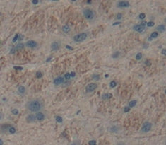 Amyloid Beta Precursor Protein Binding Protein B3 (APBB3) Polyclonal Antibody - image 3