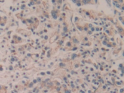 DAB staining on fromalin fixed paraffin- embedded Kidney tissue)