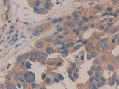 Amyloid Beta Precursor Protein Binding Protein A2 (APBA2) Polyclonal Antibody - image 4