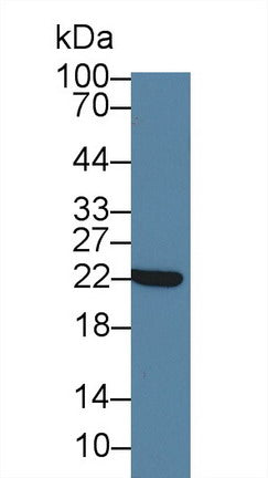 DAB staining on IHC-P; Samples: Human Kidney Tissue; Primary Ab: 10µg/ml Rabbit Anti-Human CRYaB Antibody Second Ab: 2µg/mL HRP-Linked Caprine Anti-Rabbit IgG Polyclonal Antibody
