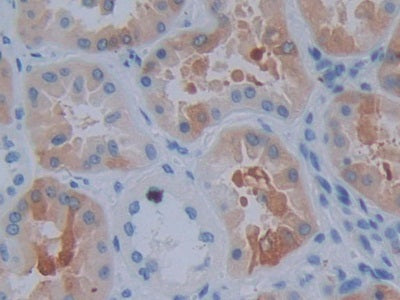DAB staining on IHC-P; Samples：Human Kidney Tissue.