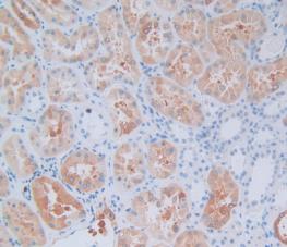 Crystallin Alpha B (CRYaB) Polyclonal Antibody - image 5