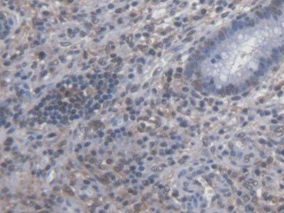 DAB staining on IHC-P; Samples: Human Liver Tissue