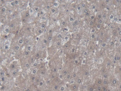 Symplekin (SYMPK) Polyclonal Antibody - image 5