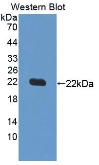 Supervillin (SVIL) Polyclonal Antibody - image 2
