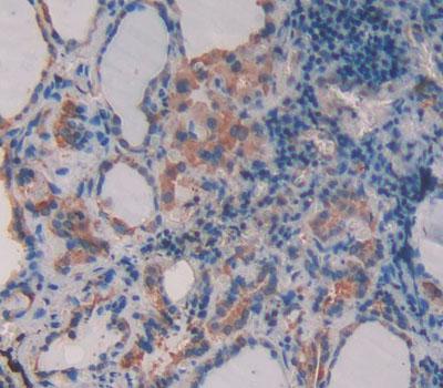 Supervillin (SVIL) Polyclonal Antibody - image 3