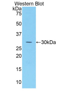 Sulfatase Modifying Factor 1 (SUMF1) Polyclonal Antibody - image 2