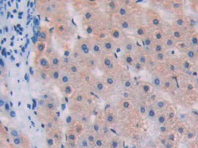DAB staining on fromalin fixed paraffin- embedded liver tissue)