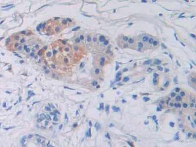 Sulfatase Modifying Factor 1 (SUMF1) Polyclonal Antibody - image 4