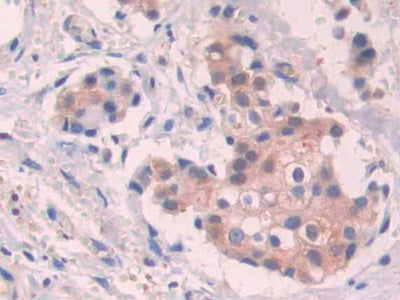 Stanniocalcin 1 (STC1) Polyclonal Antibody - image 4