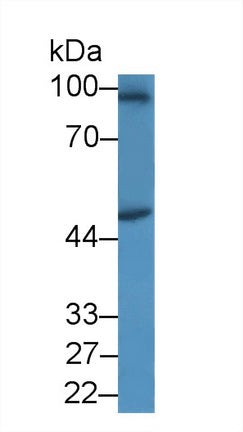 Western Blot; Sample: Recombinant protein.